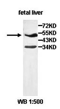 AGXT2L2 Rabbit Polyclonal Antibody