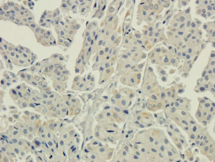AHI1 Rabbit Polyclonal Antibody