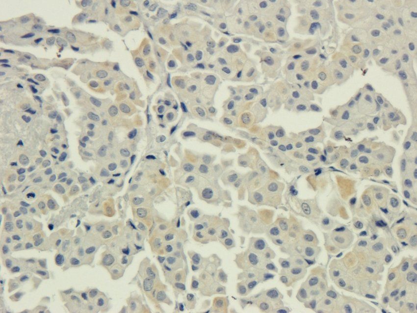 AHI1 Rabbit Polyclonal Antibody