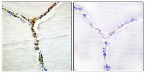 AhR (Phospho-Ser36) Antibody