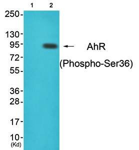 AhR (Phospho-Ser36) Antibody