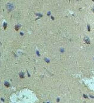 AHSA1 Rabbit Polyclonal Antibody