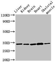 AHSA2P Antibody