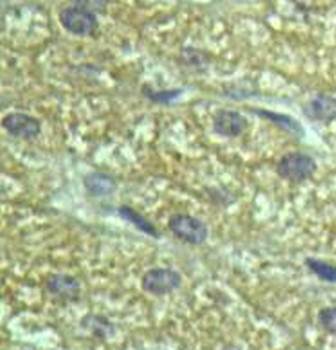 AHSP Rabbit Polyclonal Antibody