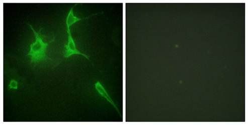 Collagen IX α3 Antibody