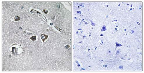 Collagen XI α2 Antibody