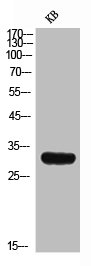 AIMP1 Antibody