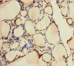 AK1 Antibody