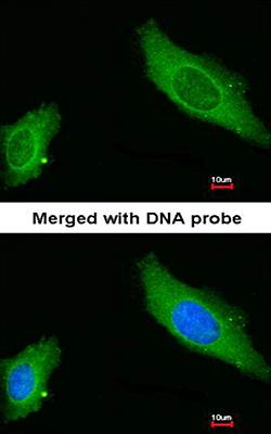 AKAP12 Rabbit Polyclonal Antibody