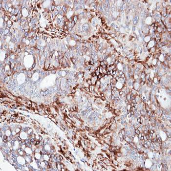 AKAP12 Rabbit Polyclonal Antibody
