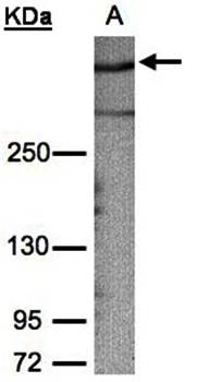 AKAP12 Rabbit Polyclonal Antibody