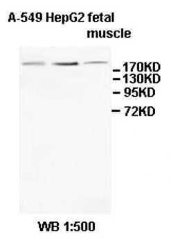 AKAP13 Rabbit Polyclonal Antibody