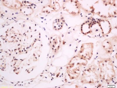 AKAP2/PALM2 Rabbit Polyclonal Antibody