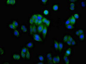 AKR1C1 Antibody