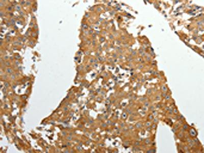 AKR1C1 Antibody