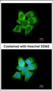 aldo-keto reductase family 1 member C1 Antibody