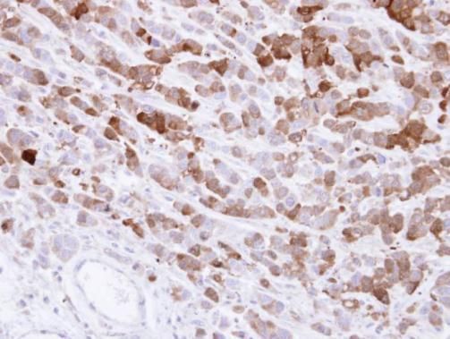 aldo-keto reductase family 1 member C1 Antibody