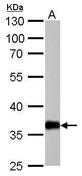 aldo-keto reductase family 1 member C1 Antibody