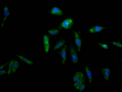 AKR1C3 Antibody