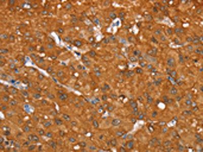 AKR1C4 Antibody