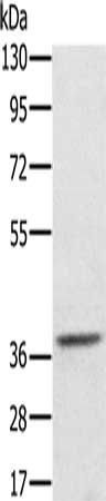 AKR1C4 Antibody