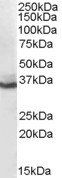 Goat anti-AKR1C4 Antibody