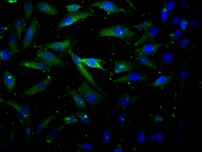 AKT1 Antibody