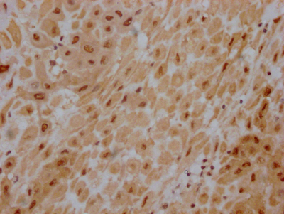 AKT1 Antibody