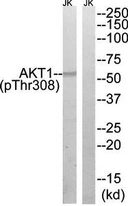 AKT1 (Phospho-Thr308) Antibody
