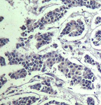 AKT1/AKT2/AKT3 (phospho-Tyr315/316/312) Antibody