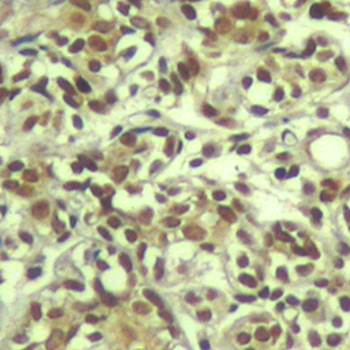 AKT1 (phospho-Thr450) Antibody