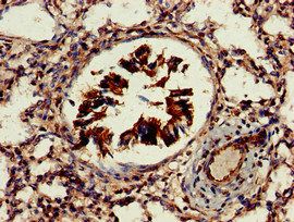 AKT1S1 Antibody