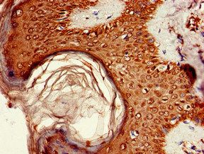 AKT1S1 Antibody