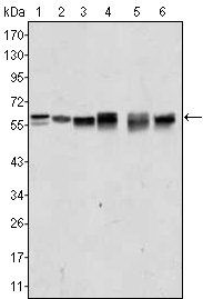 AKT2 Antibody
