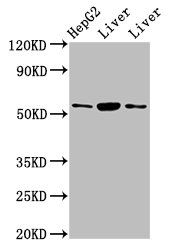 GPT Antibody