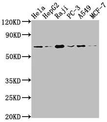 ALAS1 Antibody