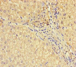 ADH1B Antibody