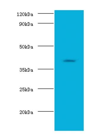ADH1B Antibody
