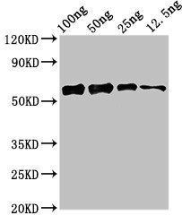 ald1 Antibody