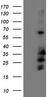 ALDH3A2 Antibody