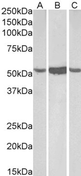 Goat anti-ALDH1A1 (C Terminus) Antibody