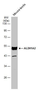aldehyde dehydrogenase 1 family member A2 Antibody