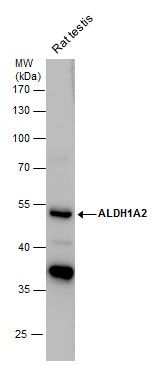 aldehyde dehydrogenase 1 family member A2 Antibody