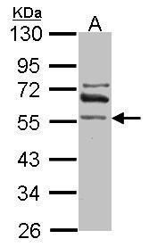 aldehyde dehydrogenase 1 family member A2 Antibody