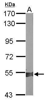 aldehyde dehydrogenase 1 family member A2 Antibody