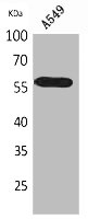 ALDH2 Antibody