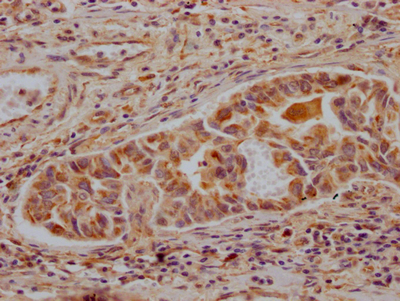 ALDH2 Antibody