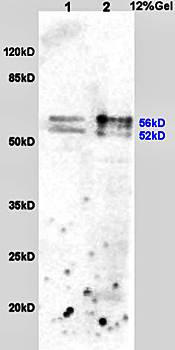 ALDH2 Rabbit Polyclonal Antibody