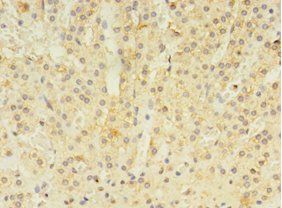 ALDH3B2 Antibody