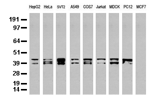 ALDH7A1 Antibody